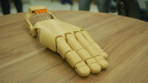 Jovem ganha – de graça - prótese de mão feita em impressora 3D