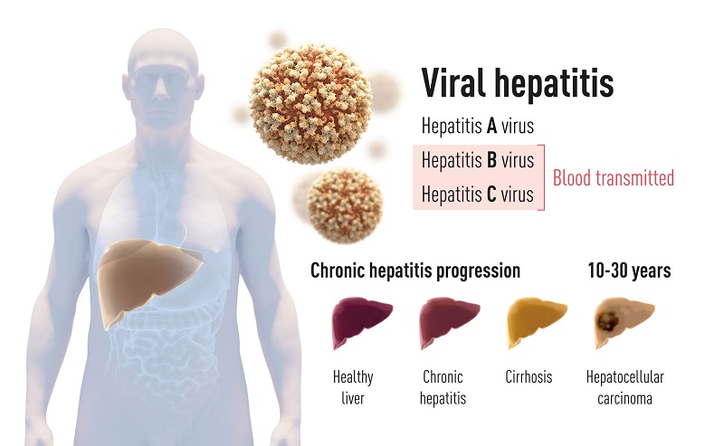 Cientistas que identificaram o vírus transmissor da Hepatite C ganham o Nobel de Medicina 2020