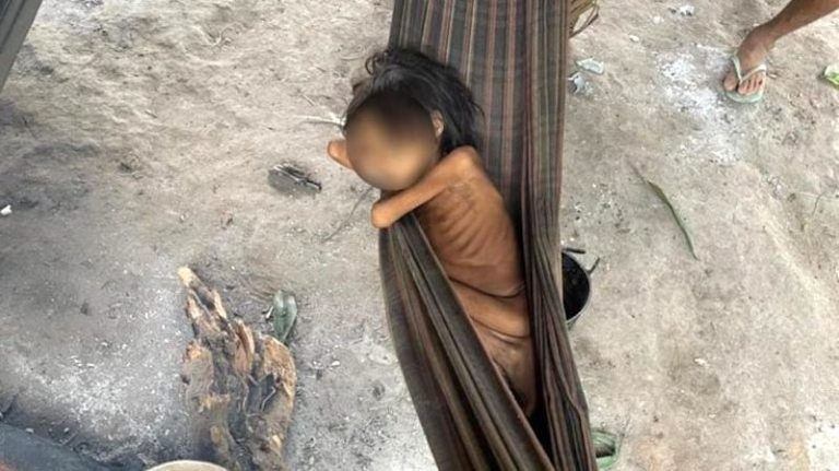 Foto de menina indígena desnutrida alerta para abandono dos Yanomami