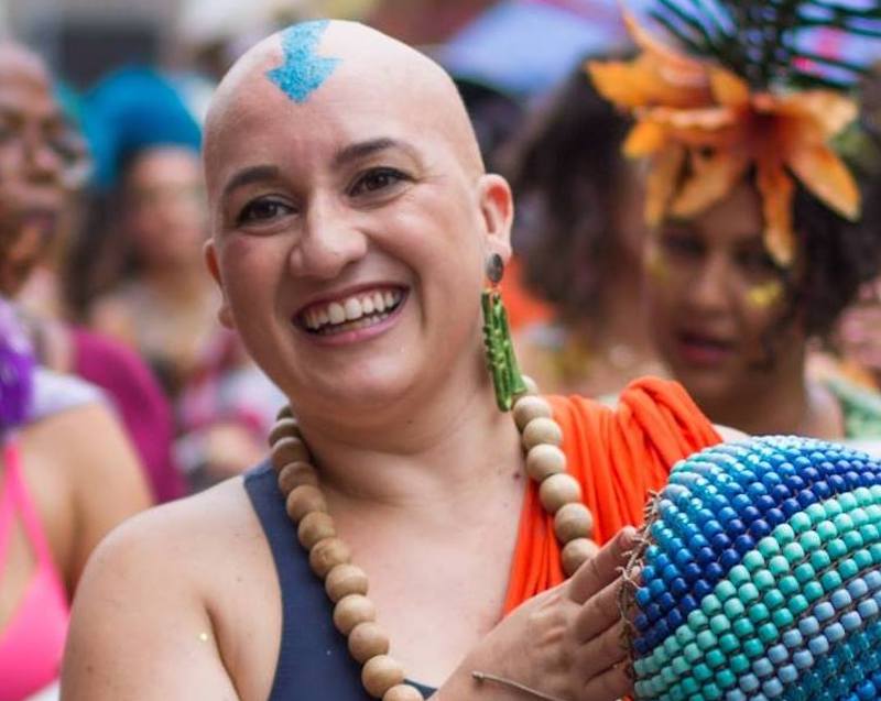 Dançarina com alopecia abandona peruca e inspira outras mulheres: careca e  linda, Celebridades